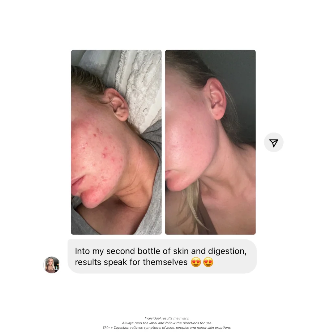 Skin + Digestion Twin Pack - 2 Month Supply - Image 3